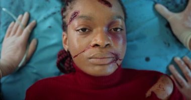 Sağlık görevlileri kalp atışlarını kontrol ediyor ve genç bir kadının yüzüne oksijen maskesi takıyor. Hastanedeki sedyeyle yatan kafa travması geçiren Afro-Amerikan kız..