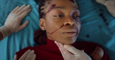 Kan ve kafa travması geçiren Afro-Amerikan bir kızın hastane sedyesinde yatarken ölüşünün en iyi görüntüsü. Ağır yaralı genç bir kadın ambulansla gidiyor. Kaza kavramı.