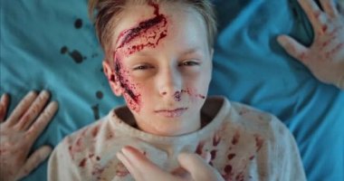 Kafa yaralanması geçiren küçük bir çocuk hastane sedyesinde yatarken bilincini kaybediyor. Sağlık görevlilerinin oksijen solunum maskesini çıkartıp çocuğu kanla çevresine getiriyorlar..