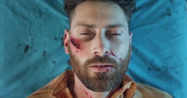 Top view of bearded guy with blood and head traumas dying while lying on hospital stretcher. Man in 40s with serious injuries going in ambulance. Concept of accident. — Stock Video