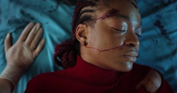Primer plano de una joven con lesiones en la cabeza acostada en un estratador médico en ambulancia. Chica afroamericana inconsciente con herida y sangre en la cabeza cabalgando al hospital después de un accidente. — Vídeo de stock