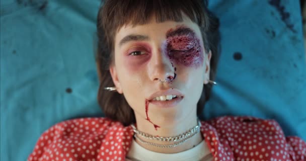 피와 머리 부상을 입은 10 대 여성이 들것에 누운 채 눈을 뜨고 웃고 있습니다. 코 고리가 있는 부상 당한 소녀의 근접 사진이 그의 감각에 도달 했습니다. 보건에 대한 개념. — 비디오