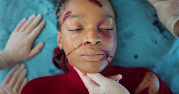 Bovenaanzicht van jonge vrouw met bloed en hoofdtrauma 's liggend op ziekenhuisbrancard. Paramedici geven een geruststellende pols aan Afro-Amerikaans meisje met verwondingen in de ambulance. Begrip ongeval. — Stockvideo