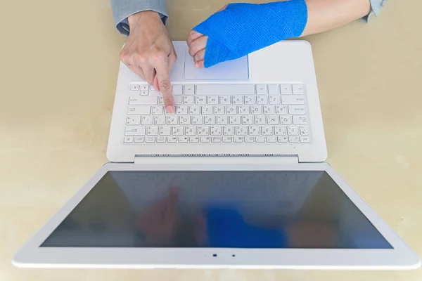 kadın mavi elastik bandaj ile el üstünde Laptop ofiste çalışan yaralı.
