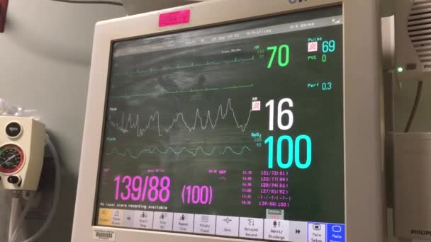 Kardiogramm Der Herzschlag Des Patienten Auf Dem Monitor — Stockvideo