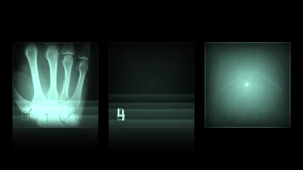 Animation Röntgenbilder Auf Schwarzem Hintergrund — Stockvideo