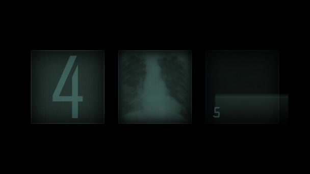 Animatie Röntgenpanelen Zwarte Achtergrond — Stockvideo