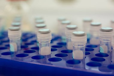 Mavi etiketlere sahip mavi tepside test tüpleri