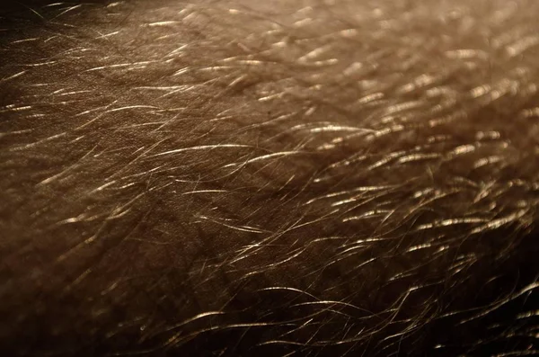 Hair Human Skin Closeup — Stock Photo, Image