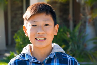 Genç çocuk diş diş telleri ile Asya çocuk portresi. Gülümseyen ve onun ortodontik diş telleri dişlerinde gösterilen genç genç çocuk.