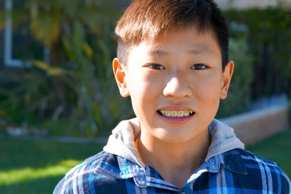 Retrato Joven Chico Asiático Con Aparatos Dentales Joven Adolescente Sonriendo — Foto de Stock