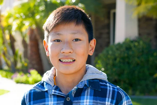 Portretul Unui Băiat Asiatic Aparate Dentare Tânăr Adolescent Zâmbind Arătându — Fotografie, imagine de stoc