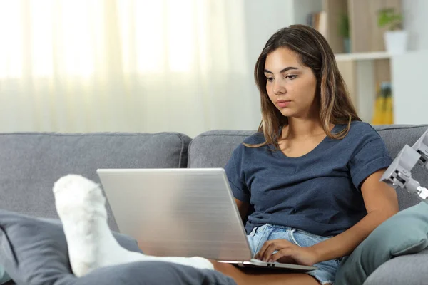 严重的 Desabled 妇女使用笔记本电脑坐在沙发上的客厅在家里 — 图库照片