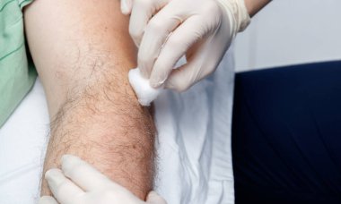 Bir fizyoterapistin elleri kuru iğne yapıyor.