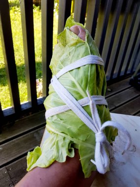 Beyaz lahana yapraklarıyla sarılı bacaklar. Lahana Yaprakları Hastalıkları Vücudumuzdan Çıkarabilir. Ağrı kesici olarak lahanaya sarılmış bacak.