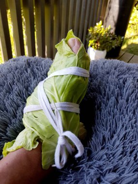 Beyaz lahana yapraklarıyla sarılı bacaklar. Lahana Yaprakları Hastalıkları Vücudumuzdan Çıkarabilir. Ağrı kesici olarak lahanaya sarılmış bacak.