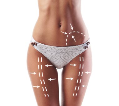 Yağ kaybetmek, liposuction, spor, fitness, sağlıklı beslenme, beslenme, uygun şekil ve selülit kaldırma kavramı. Kadın vücudunda oklarla.