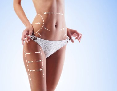 Yağ kaybetmek, liposuction, spor, fitness, sağlıklı beslenme, beslenme, uygun şekil ve selülit kaldırma kavramı. Kadın vücudunda oklarla.