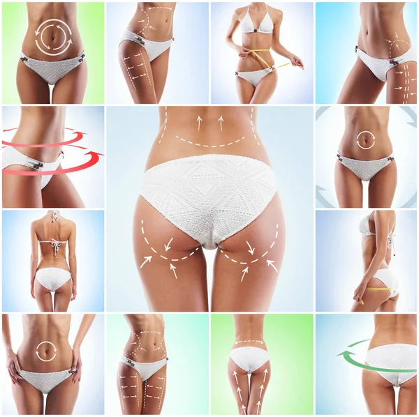 Collage Verschiedener Fotos Des Weiblichen Körpers Mit Zeichnungspfeilen Fettabbau Gesundheit — Stockfoto