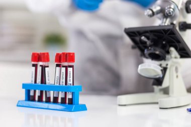 Virüs tanımlama etiketli kan tüpleri laboratuvarda çalışan bir mikrobiyologun önüne yerleştiriliyor..