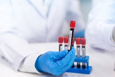 Doktorun eli, laboratuvar teknisyeninde analiz için üzerinde kan tüpü örnekleri olan mavi lastik bir eldiven giyiyor. Araştırma laboratuarındaki kan tüplerini test edin..