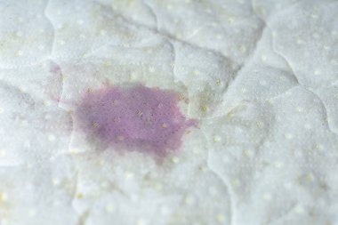 Wet stain of spilled red wine on bed. Red wine stain on white be