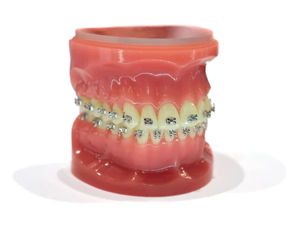 Color Orthodontic Teeth Models Dental Education Model Jaws Half Ceramic — Stock Photo, Image