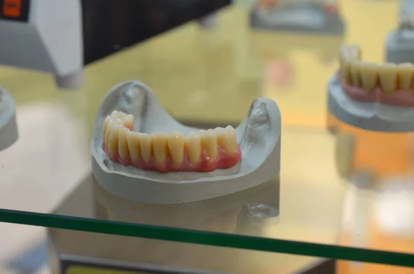 口腔牙科模型义齿培养模型的研究 — 图库照片