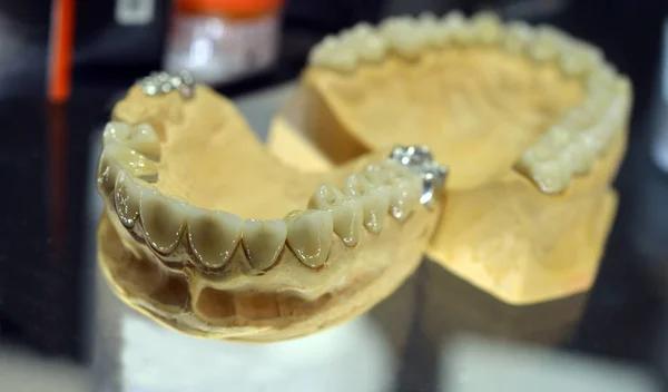 口腔牙科模型义齿培养模型的研究 — 图库照片