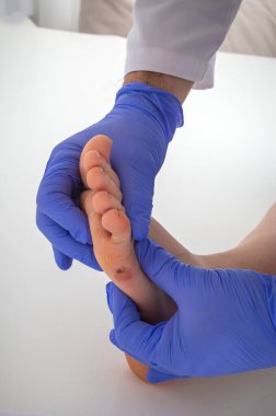 Doktor kadın insan bacağını ayak mısırıyla muayene ediyor.