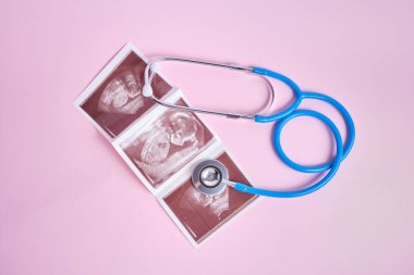 Pembe arka planda embriyonun stetoskop ve ultrason taraması, hamilelik konsepti