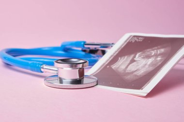 Pembe arka planda embriyonun stetoskop ve ultrason taraması, hamilelik konsepti