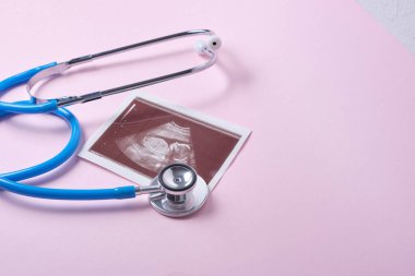 Pembe arka planda embriyonun stetoskop ve ultrason taraması, hamilelik konsepti