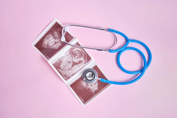 Stethoskop Und Ultraschall Des Embryos Auf Rosa Hintergrund Schwangerschaftskonzept — Stockfoto