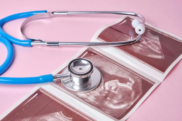Stethoskop Und Ultraschall Des Embryos Auf Rosa Hintergrund Schwangerschaftskonzept — Stockfoto