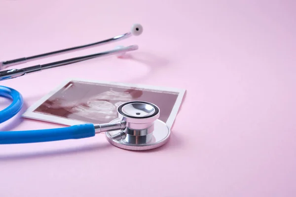 Stetoskop Dan Usg Scan Embrio Pada Latar Belakang Merah Muda — Stok Foto