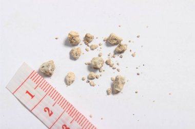 Beyaz arka plan, düz yatıyordu veya en iyi görünüm çok küçük böbrek taşı