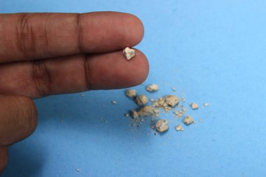 düz yatıyordu veya en iyi görünüm çok küçük Böbrek taşına parmak mavi arka plan