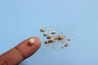 düz yatıyordu veya en iyi görünüm çok küçük Böbrek taşına parmak mavi arka plan