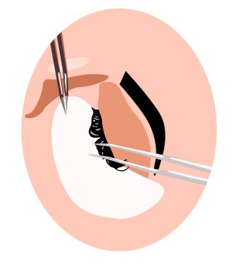 Kirpik, uzatma çizimi nasıl yere yanlış eyelashes