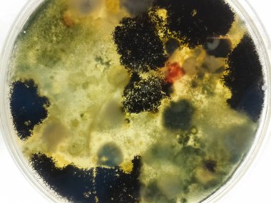 Petri kabına bir örnek bir bilimsel Mikrobiyoloji Laboratuvar büyüyen sonra siyah ve kırmızı mantar ile. Çeşitli şekil ve renklerde büyüme ile kalıp mikolojik örnek.