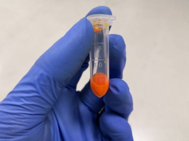 Koruyucu eldivenleri olan bir bilim adamı, elinde turuncu kimyasal olan bir şişe tutuyor.