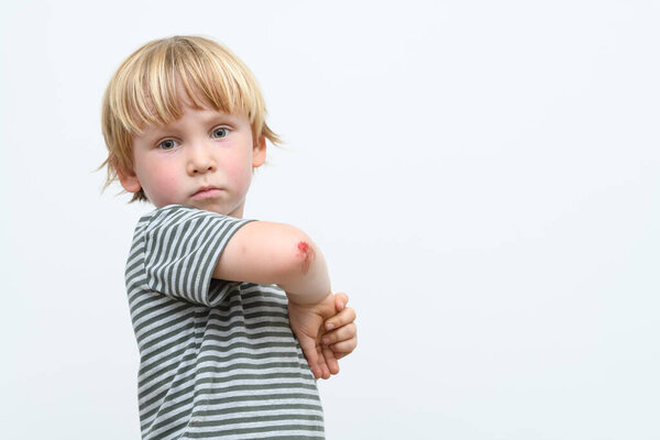 boy kid arm accident wound he painful abrasion scratches from fall, medical health concept