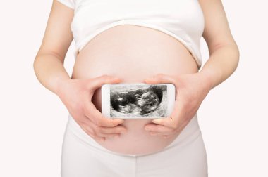 Kırpılmış bir resmi bir hamile kadının sonogram resim ile bir akıllı telefon gidiyor