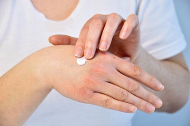 Cropped image of a young woman putting moisturizer onto her hand with very dry skin and deep cracks with cream. clipart