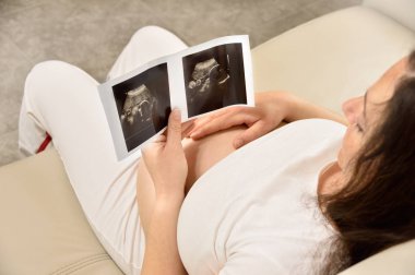 Ultrason resmini tutarken hamile bir kadının bir yüksek-açılı görünüş