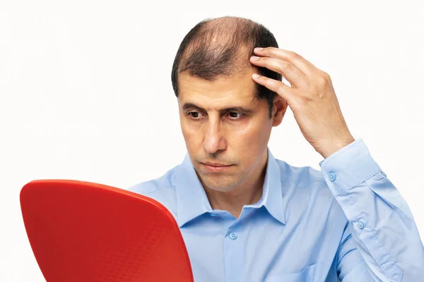 Upset Middle Aged Man Alopecia Looking Mirror Hair Loss Concept — Stock Photo, Image