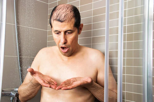 Man Showering Checking His Hair Falls Out — Stock Photo, Image