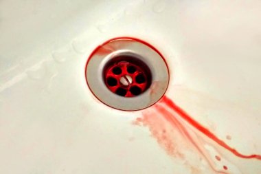 Yıkama leğeni kana bulanmış. Aile içi şiddet