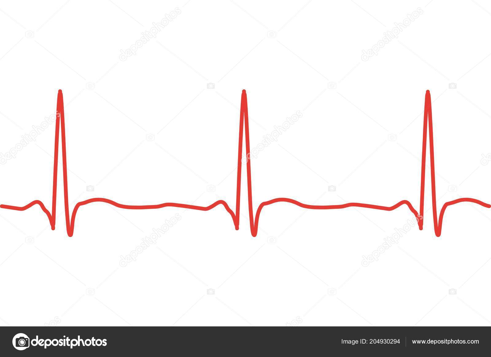 heartbeat line heartbeat line